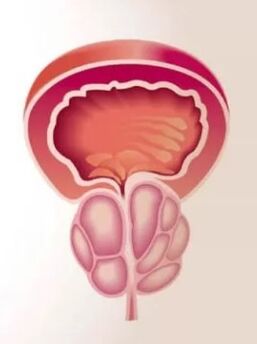 Prostate inflammation